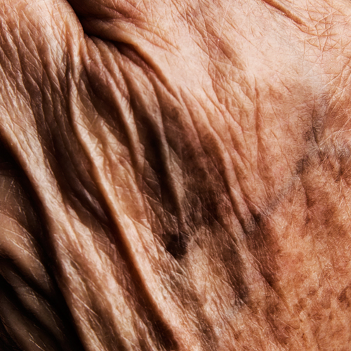 Ciclo<br/>de<br/>la Piel